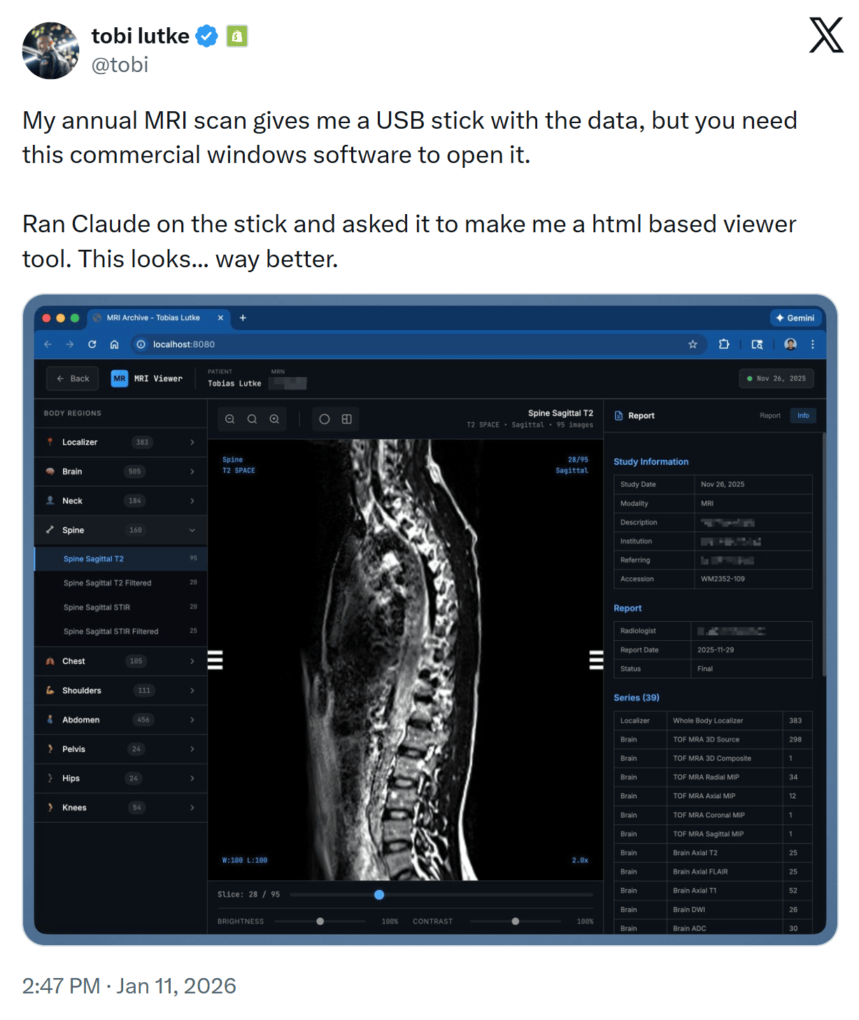 Using AI to make an HTML viewer for an MRI scan, on X